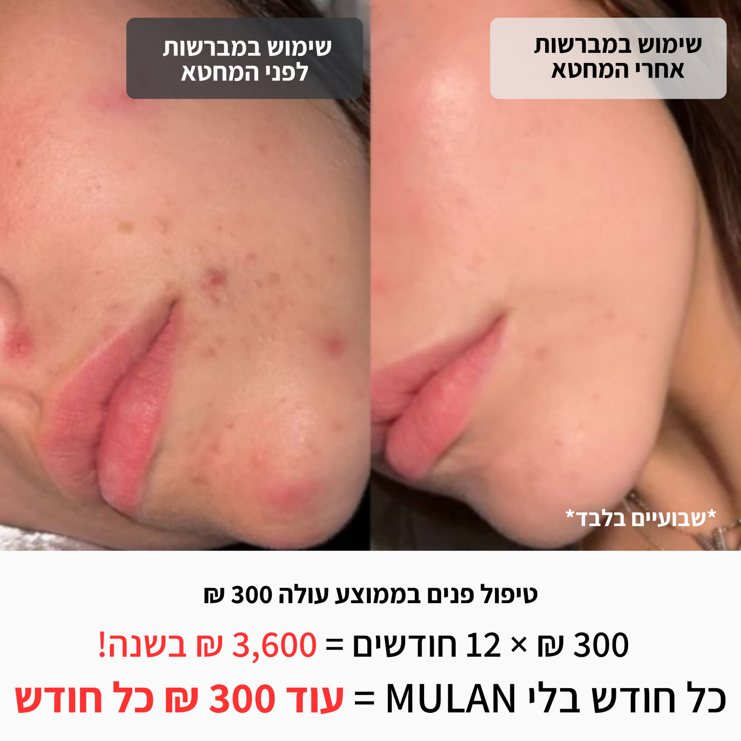 ערכת קלין גירל ™MULAN