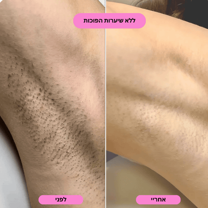 ‬סכין גילוח בטיחותית למניעת גירוי, בליטות ושיערות חודרנית